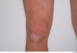 Arvid knee nude 0004.jpg